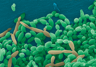 Candida tropicalis